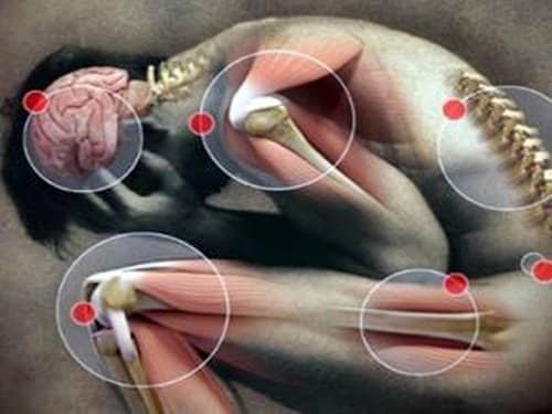 PROLOZONE+Areas+Of+Treatment+