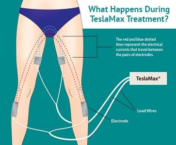 what+happens+during+a++TELSAMAX®+treatment